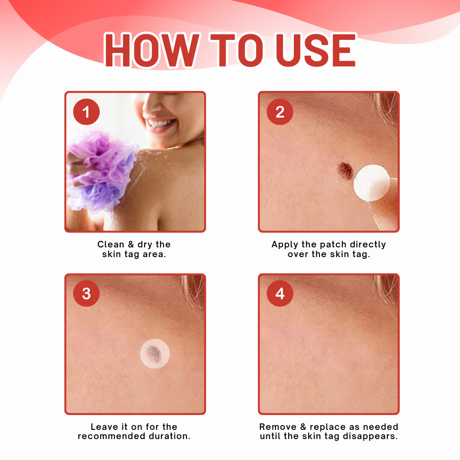 Fivfivgo® MicroDart Skin Tag Remover Patch