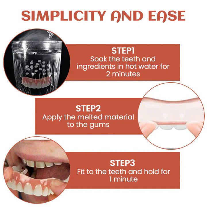 Oveallgo™ PerfectFit Denture Silicone Reline Kit